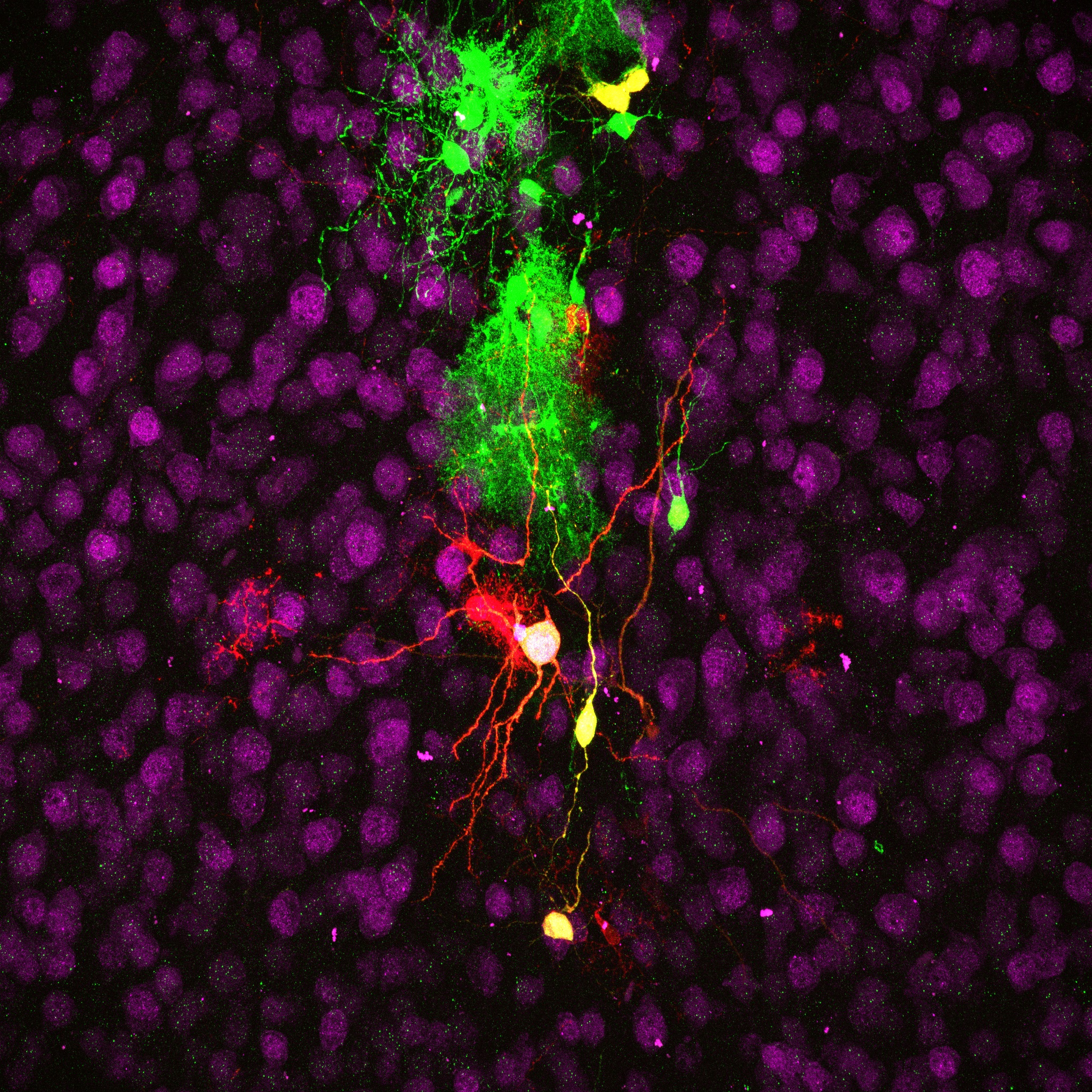 Induced neurons (in yellow) and glial cells (in red and green) in the cerebral cortex of a mouse