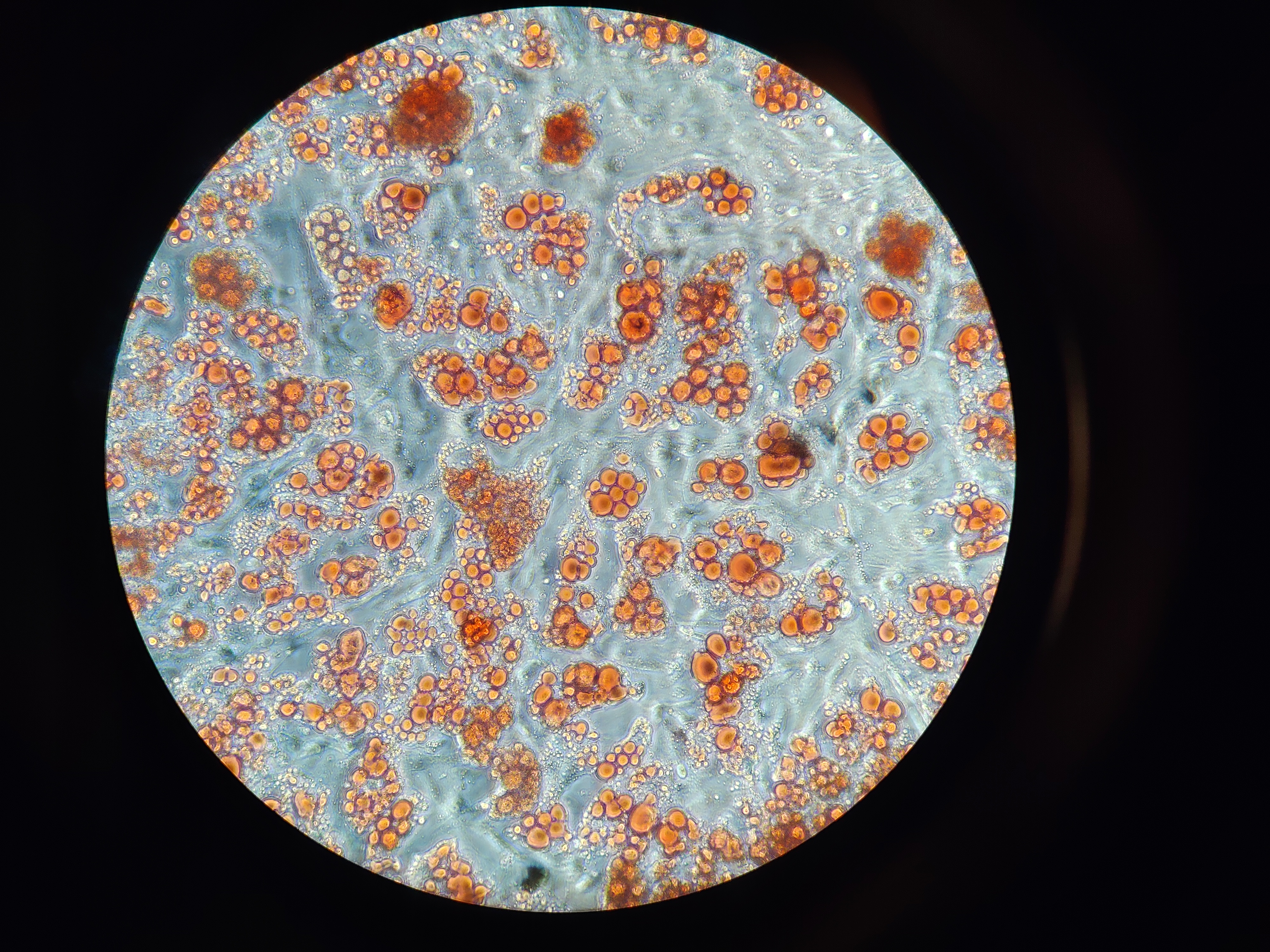 Fettzellen in Kultur, deren Fett mittels Oil-red-O Färbung rot angefärbt ist